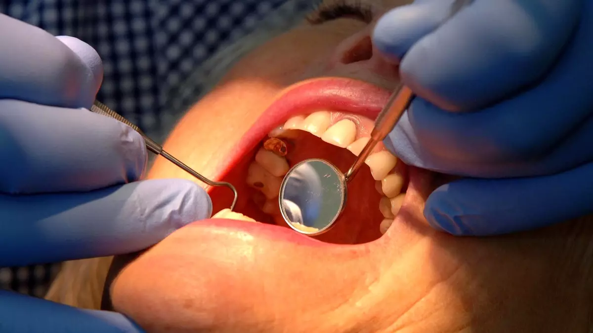 nottingham universitesinden dis minesini onaran yeni jel Kc5M1X3y.jpg